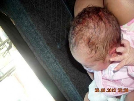 La niña tenía los restos de sangre y mucosidad del parto pegados al cuerpo. (Foto: Cortesía familia María Kristensen)